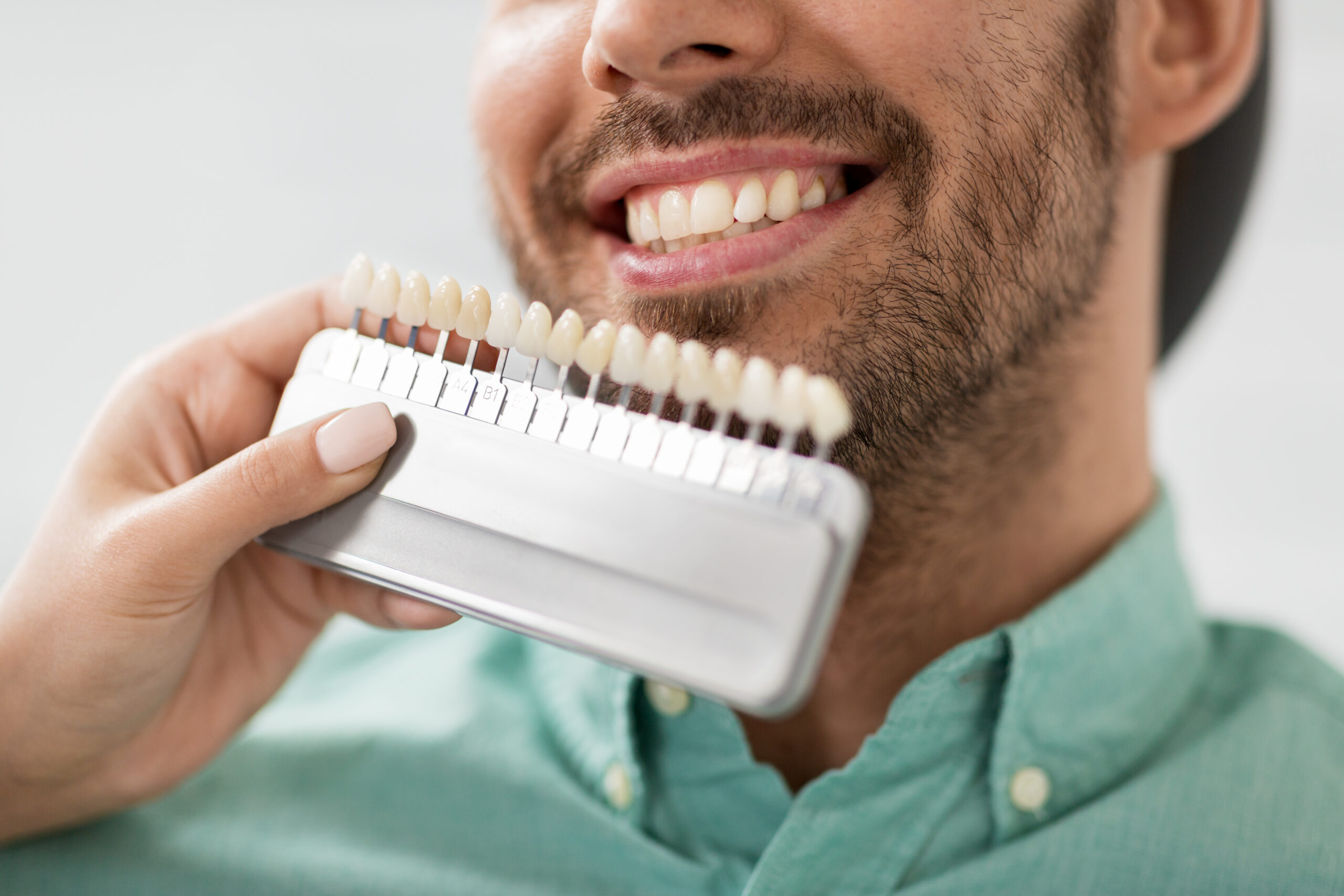 dentist choosing tooth color for patient at clinic Close up of dentist with tooth color samples choosing shade for male patient teeth at St Catharines Dental Centre