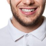 Top Solutions for a Missing Tooth: Exploring Your Options